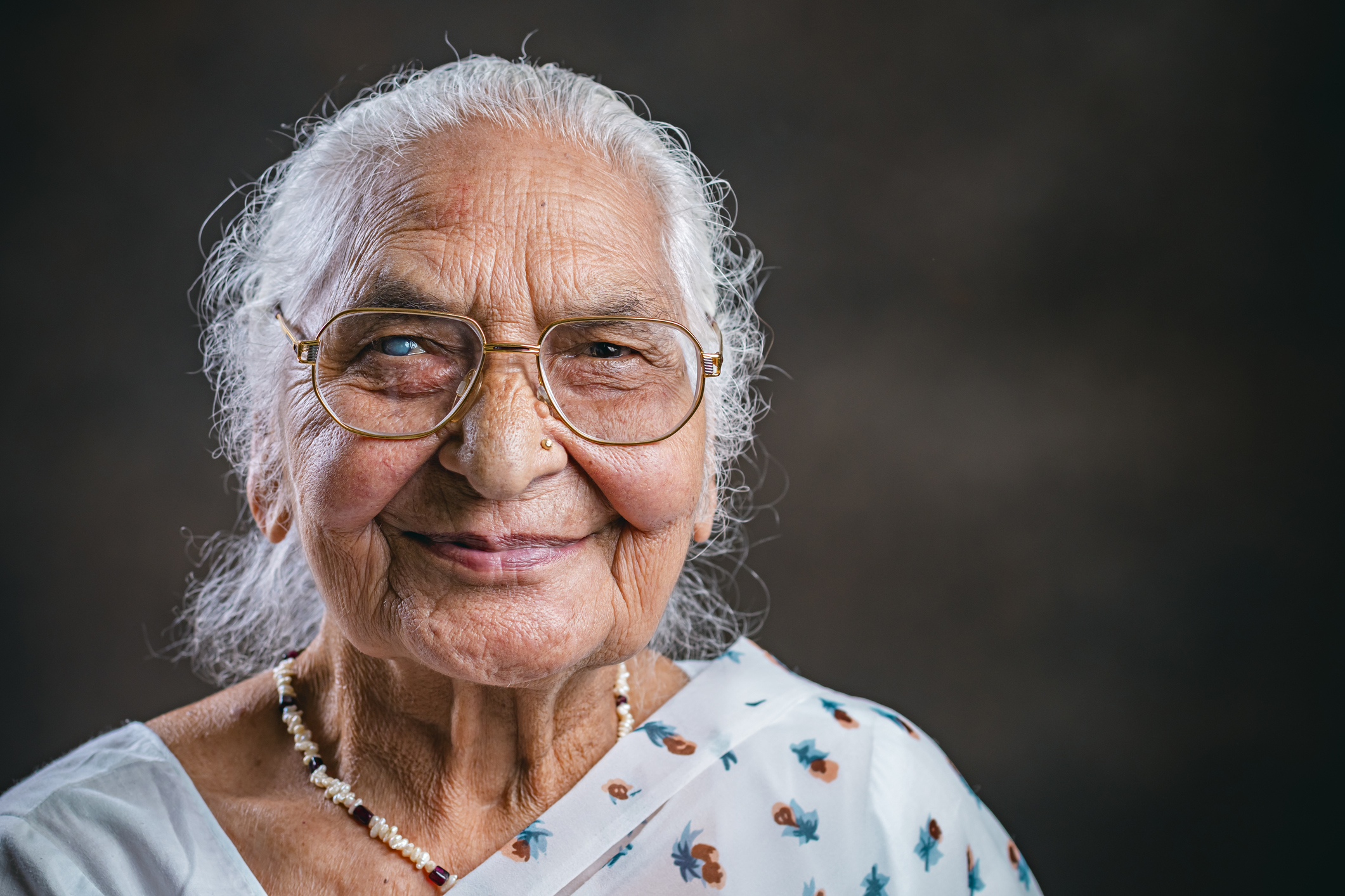 An elderly South Asian woman wearing a white sari, a beaded necklace, and gold wire rimmed glasses smiles for the camera. Her left eye is brown and healthy, while her right eye is covered by a white film substance called a cataract.