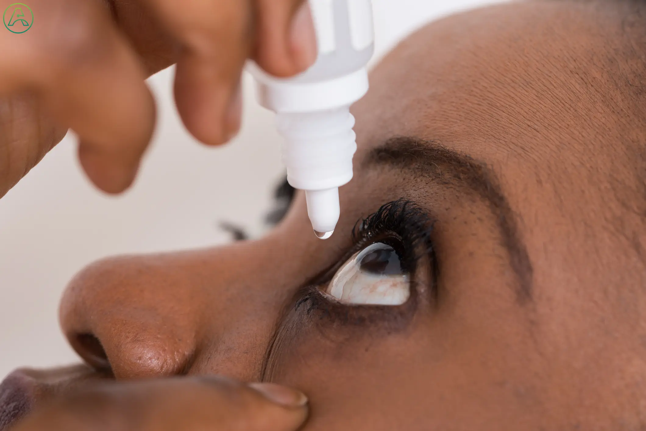 A middle-aged Black woman leans her head back and applies medicated eye drops to one eye.