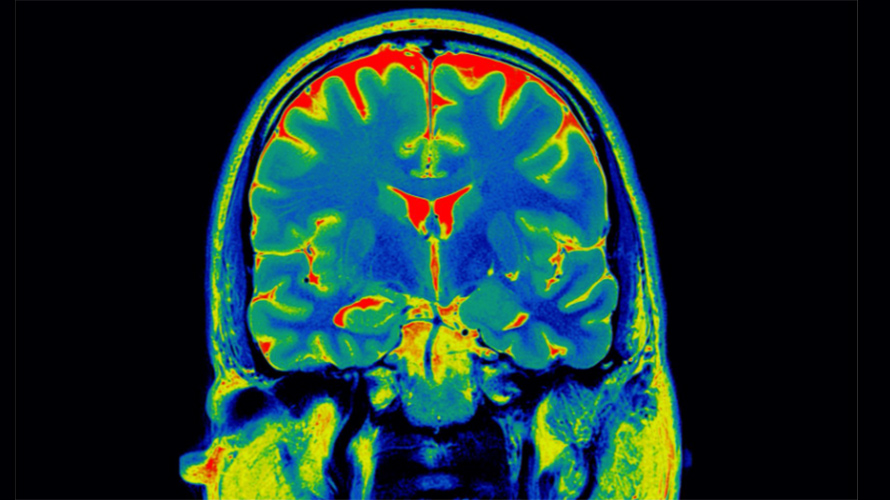 Colorful MRI image of a brain