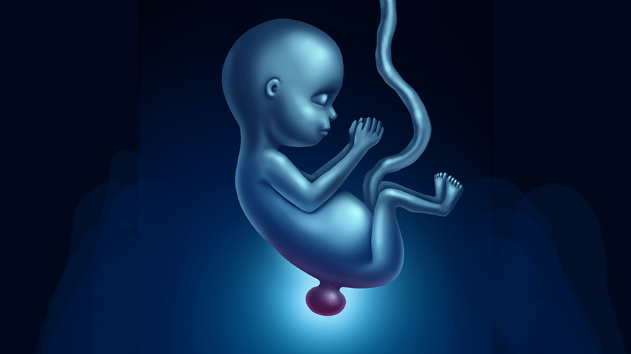 Illustration of a fetus with spina bifida; it has a bulge or sack at the base of the spine