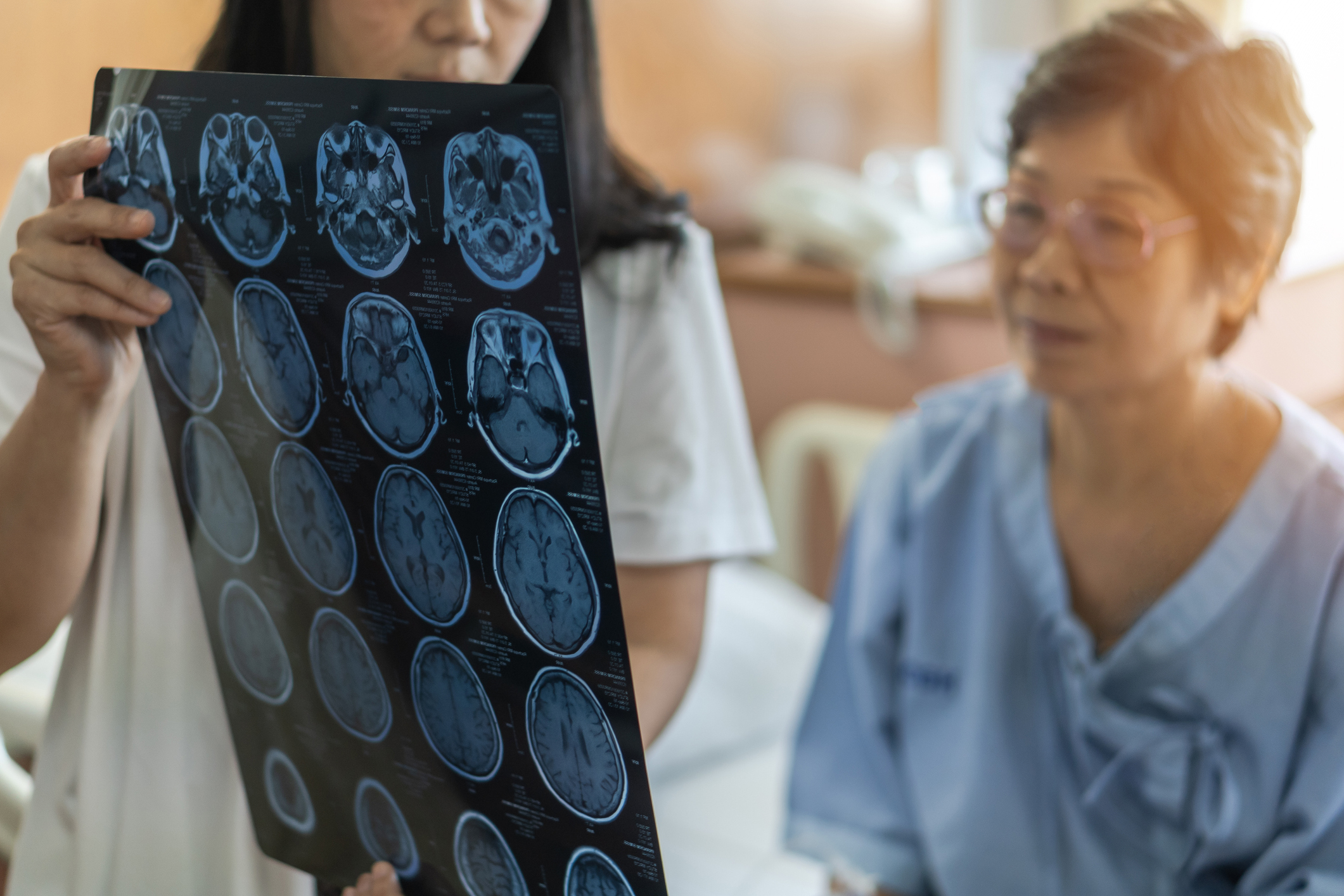 A female doctor with long black hair holds up the results of a brain scan to an older Asian woman who sits in a hospital bed wearing glasses and a blue hospital gown